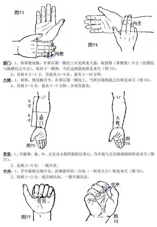 实用针灸奇穴全集，探索古老疗法在现代医学中的新应用